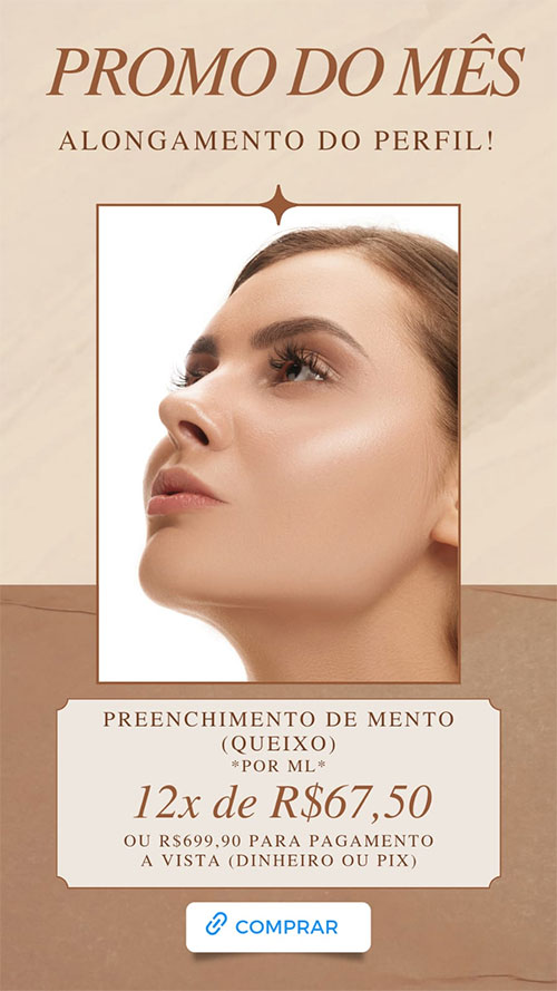 Preenchimento de Mento (Queixo) por R$ 699,90